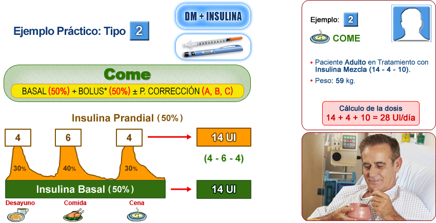 Imagen distribución de la dosis