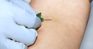 Imagen insulina intravenosa