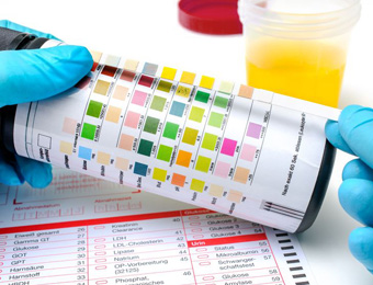 Imagen análisis orina