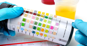 Imagen análisis orina