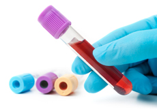 Imagen análisis sangre