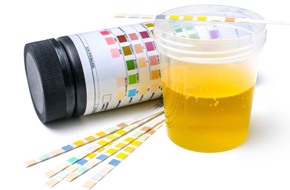 Imagen análisis orina